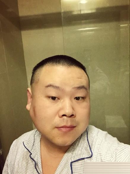 岳云鹏狂瘦8斤喊话演偶像剧,自降身段背后藏了多少不甘? 岳云鹏狂瘦8斤喊话演偶像剧,自降身段背后藏了多少不甘?